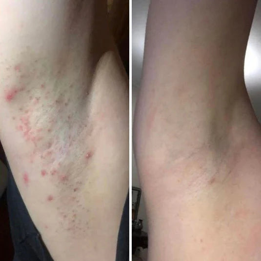 Ingrown Hair Exfoliating Scrub- Nude